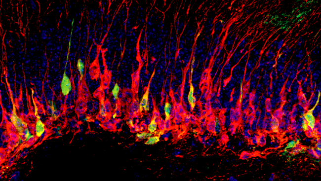Hypoxia and environmental enrichment treatments stimulated an increase in the number of new hippocampal neurons, which arise from astroglial cells. From a paper by Michael L. Schwartz, Flora M. Vaccarino et. al.