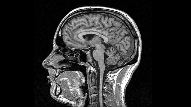 Brain Scans: Technologies That Peer Inside Your Head