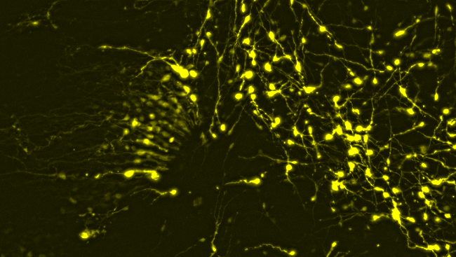 Cells in the cerebral cortex migrating away