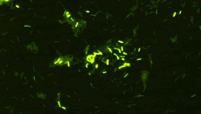 Christopher Lowry has studied the effects of treatment with a common soilbacterium called Mycobacterium vaccae (pictured) in mice. He found that M. vaccae increased the levels of the brain chemical serotonin and decreased anxiety-like behaviors.