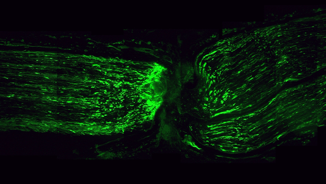 Axons in action