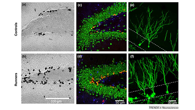 The images above show newly-born neurons in the dentate gyri of a sedentary mouse (top) and a mouse that ran on a wheel (bottom), as viewed through different microscopes. The running mouse has more new neurons in the dentate gyrus compared to the sedentary mouse.