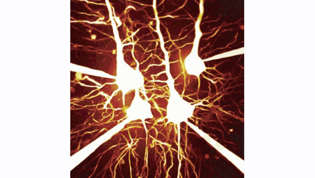 A two-photon micrograph showing layer 5 pyramidal neurons from a cortical brain slice. 