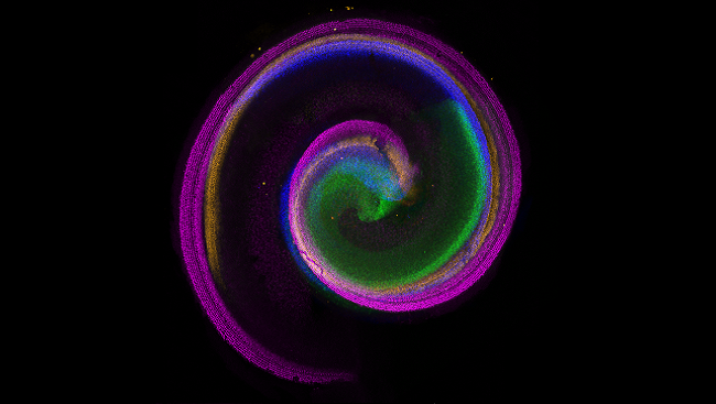 The cochlea is a spiral-shaped opening in the ear where vibrations in the air are transformed into electrical signals that the brain uses to process sound. 