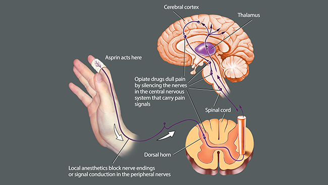 At the site of an injury, the body produces compounds called prostaglandins, which increase pain sensitivity. Aspirin relieves pain by halting the production of prostaglandins. Other analgesics work in the nervous system to relieve pain: Local anesthetics intercept pain signals traveling up the nerve and opiate drugs block the transfer of pain signals from the spinal cord to the brain. 