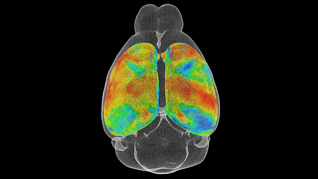 Brain scan highlighting changes in the brain related to cocain use.