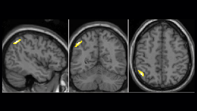 Three brains in panels