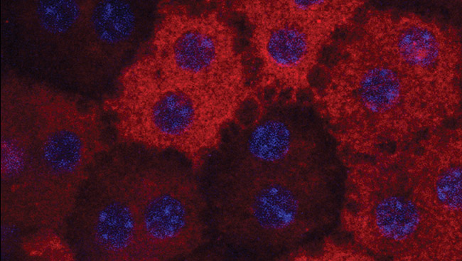 Close up image cells stained by RPE65 antibodies