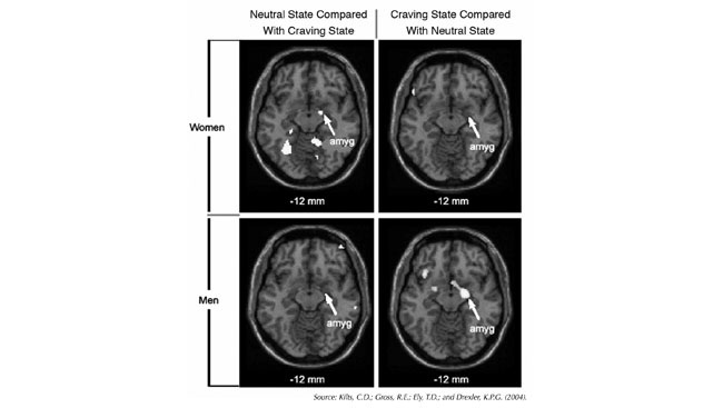 Brain scan of dopamine production activating receptors 