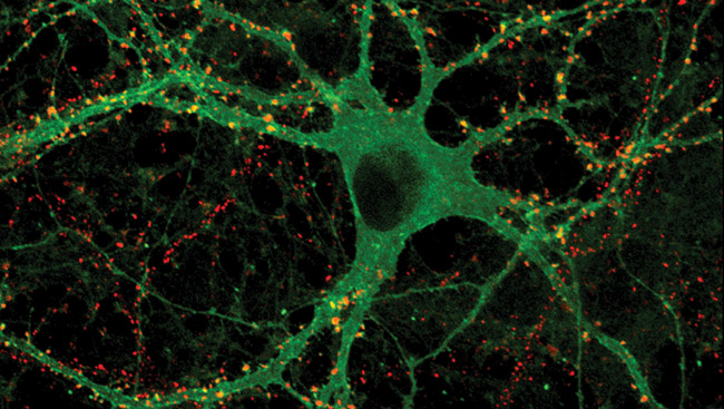 The optical switch molecules in a nerve cell