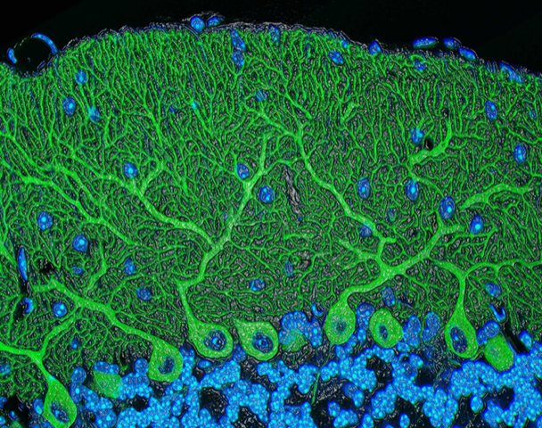 High-resolution scan of a mouse cerebellum