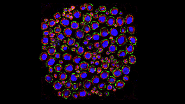 A cross section through a mouse quadriceps nerve showing discontinuous Drp2 staining (green) in the plasma membrane of Schwann cells, with axons stained for neurofilament (blue) and myelin stained for P0 (red). For more information, see the article by C. Stewart Gillespie, and Peter J. Brophy in The Journal of Neuroscience.