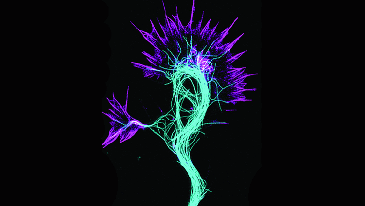 Image of the protein actin