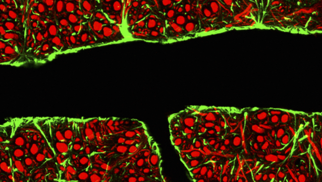 The brain’s blood vessels are lined with endothelial cells that are wedged tightly together, creating a nearly impermeable boundary between the brain and bloodstream. This image shows a section through a blood vessel (black) in the brain of a mouse as well as endothelial cells (surrounded by glial cells in green) and processed from surrounding brain cells (in red).