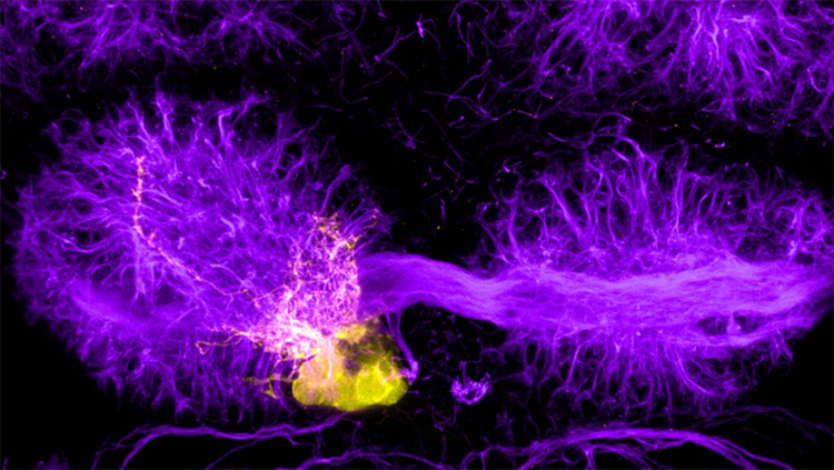 Image of the epithalamus