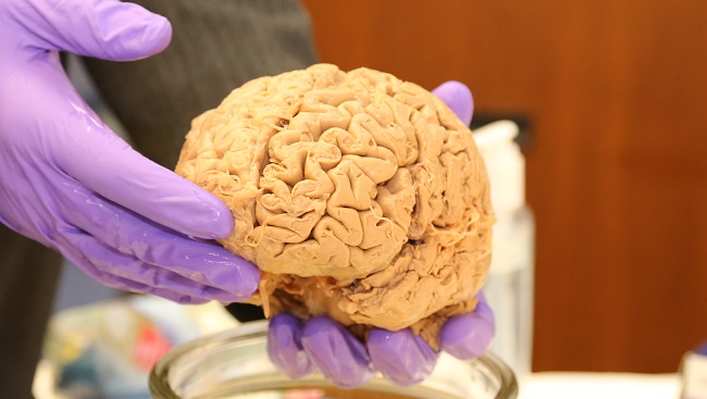 A person holding a human brain. 