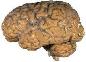 Brain Image