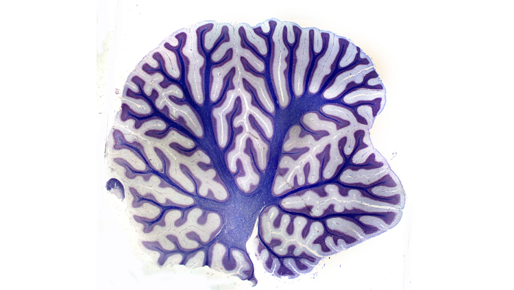 Image of a cerebellum