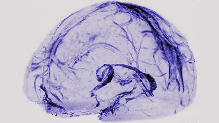 Image highlighting blood vesselsin the brain suspected to be part of the lymphatic system