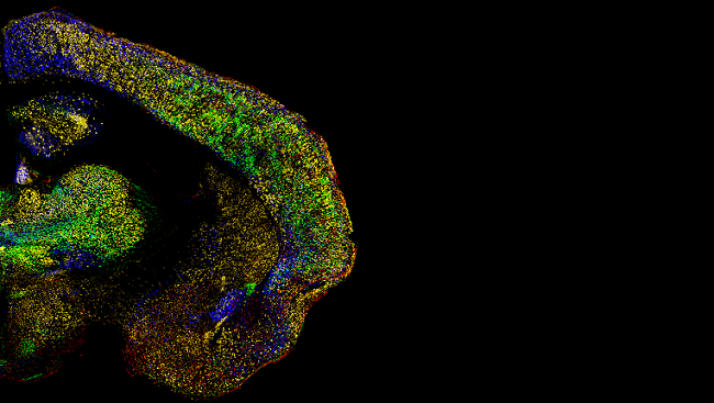 Robin J. Wagener, Csaba Dávid, Shanting Zhao, Carola A. Haas, and Jochen F. Staiger. The Somatosensory Cortex of reeler Mutant Mice Shows Absent Layering But Intact Formation and Behavioral Activation of Columnar Somatotopic Maps. The Journal of Neuroscience, 17 November 2010, 30(46):15700-15709.