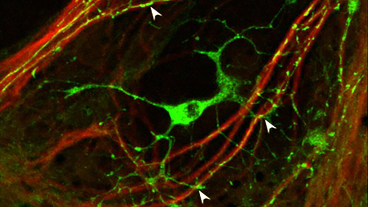 Image of oligodendrocytes