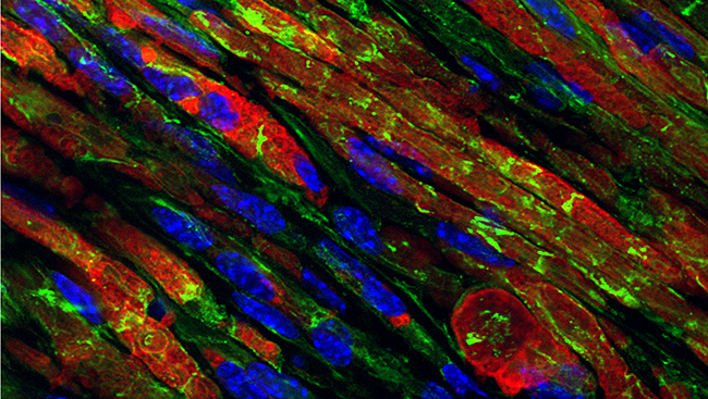 This image is a cross section of the sciatic nerve in a mouse, with individual cell nuclei in blue. 