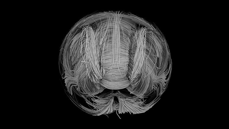 what is white matter made of in the brain