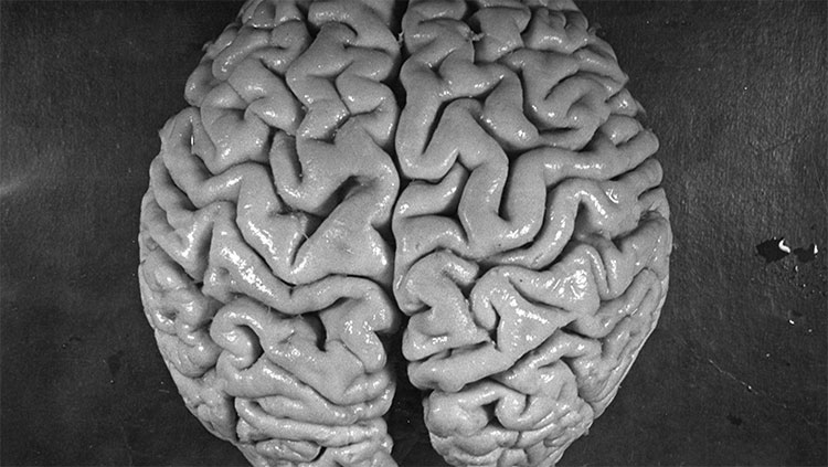 how many neurons are in the brain