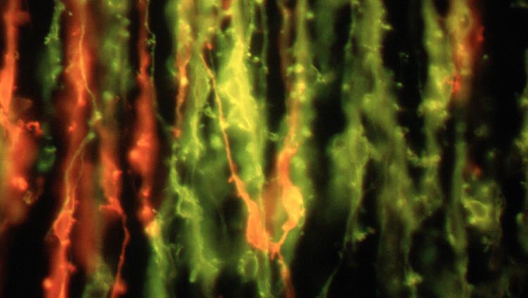 Neurons in red that will become the glossopharyngeal nerve.