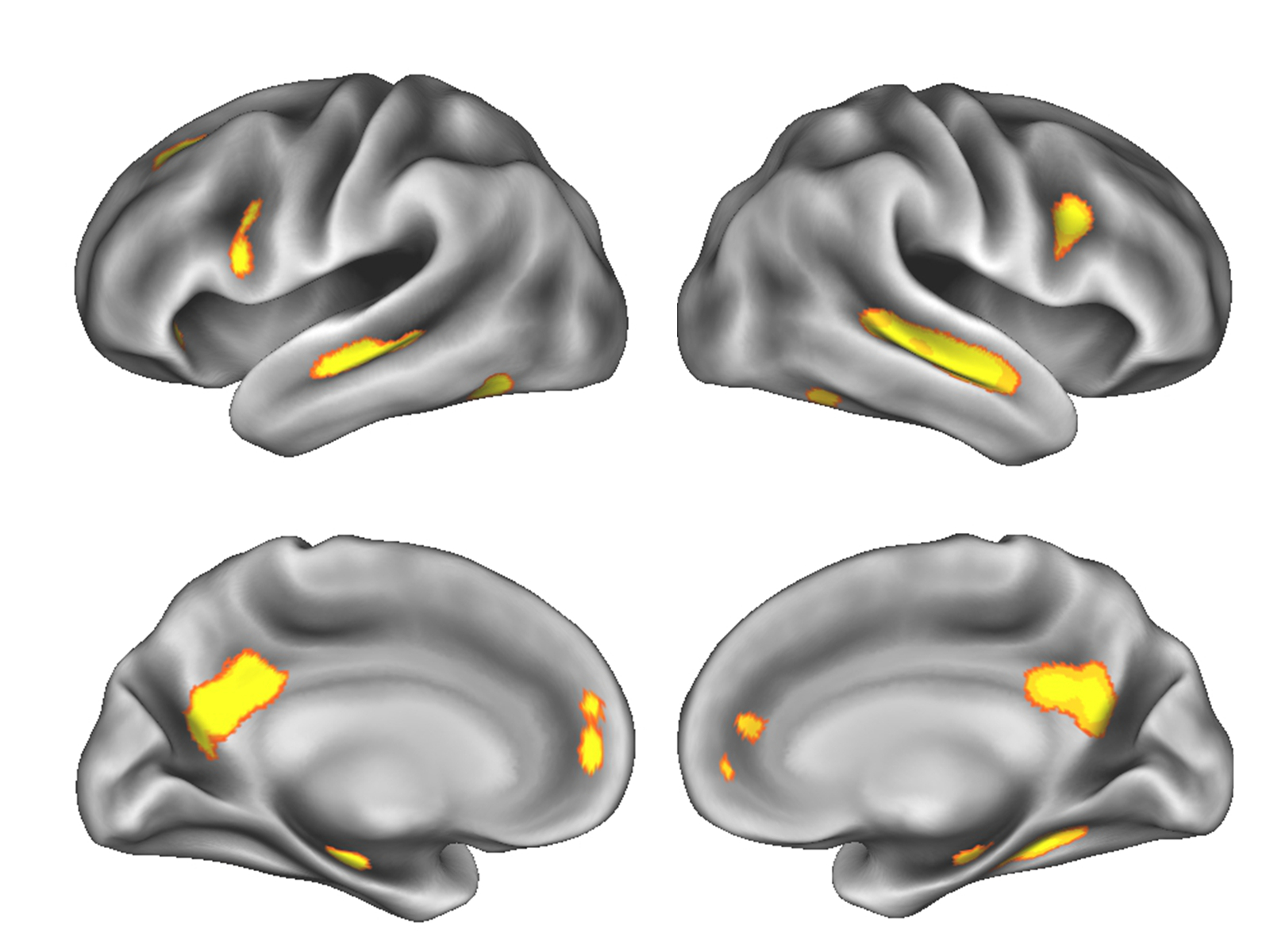 Image of gray matter changes in the brain during pregnancy