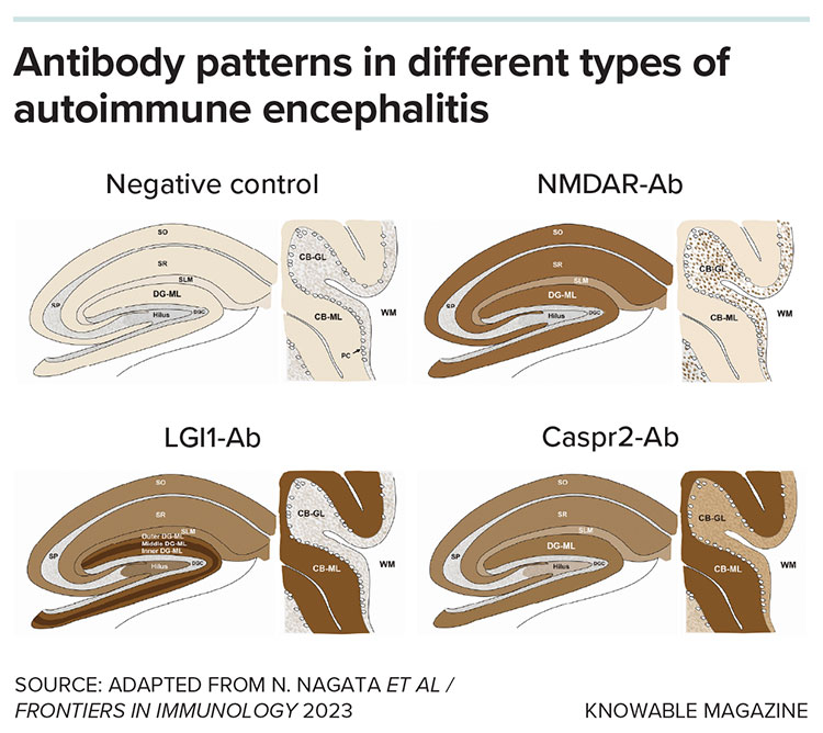 Antibody patterns