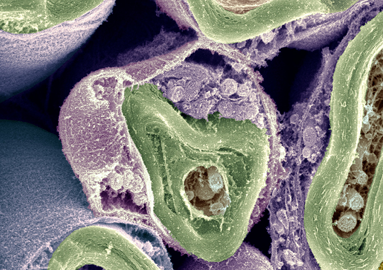 Image of Schwann Cells in purple