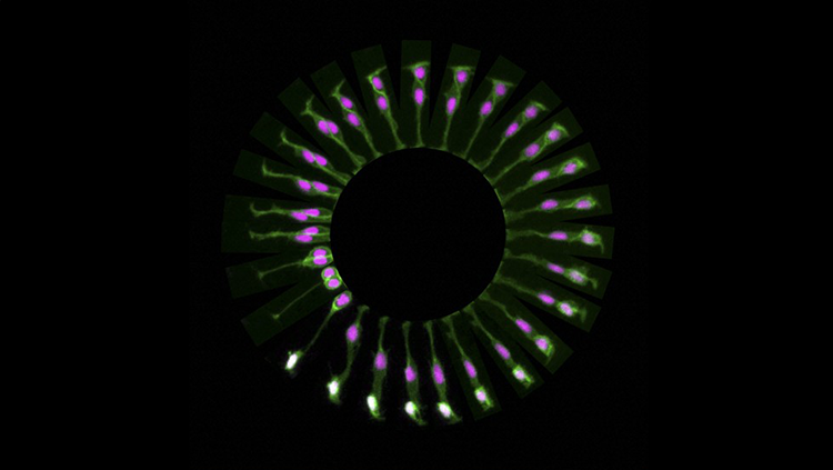 A New Neuron is Born