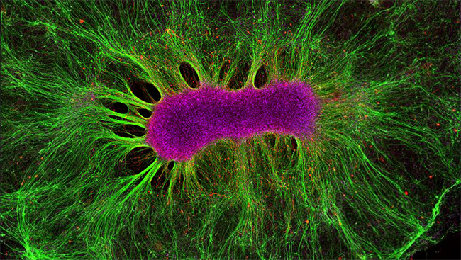 Scientists placed the above stem cell (pictured in magenta) into a synthetic gel. After two weeks, the cell spouted a web of nerve fibers (pictured in green). 