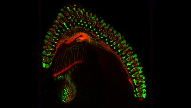 A gene controls neuronal traffic in the assembly of this electrical circuit.