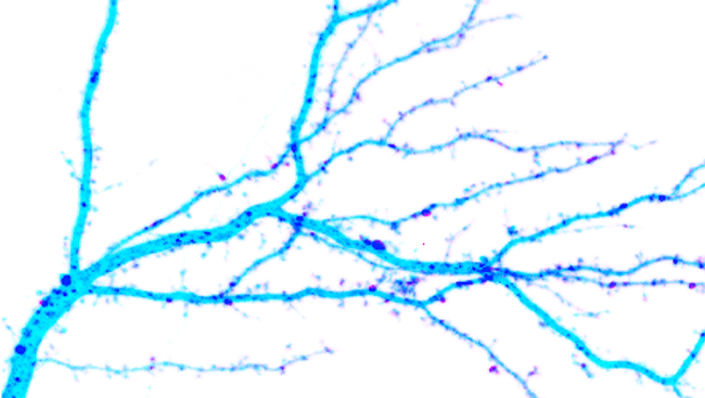 The image shows dendrites (light blue) in the hippocampus, a part of the brain involved in learning and memory. These dendrites provide special proteins (purple dots) needed for synapse function. 