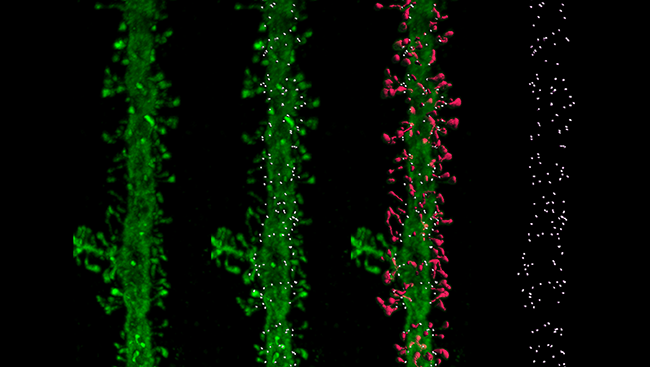 Locating the placement of tiny dendritic spines may hold  important clues for learning and memory.