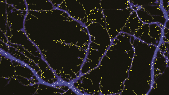 A neuronal glutamate transporter clusters at post-synaptic sites. Confocal image of 11 day old cultured hippocampal neurons co-transfected with constructs expressing soluble cyan fluorescent protein (blue) and full-length glutamate transporter, EAAT3, fused to a yellow fluorescent protein (yellow). EAAT3 is seen in clusters on the dendritic surface and on spines and filopodia, whereas the soluble cyan fluorescent protein fills the entire cell.