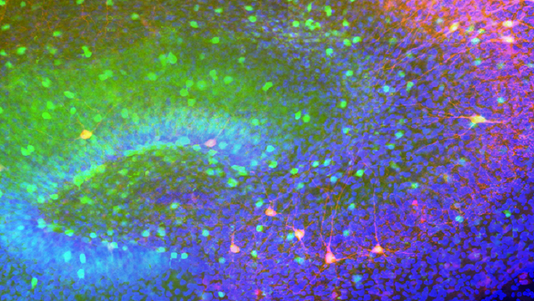 Image of part of a mouse hippocampus, with all the neurons expressing GAD67 labeled in green