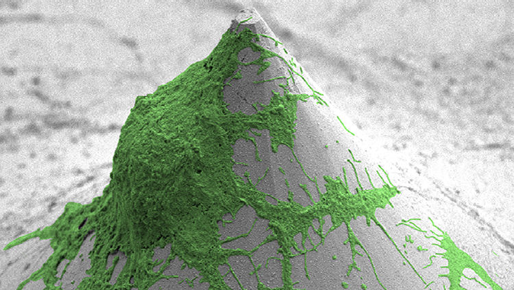 A single oligodendrocyte growing on a special plate with tiny, cone-shaped projections. 