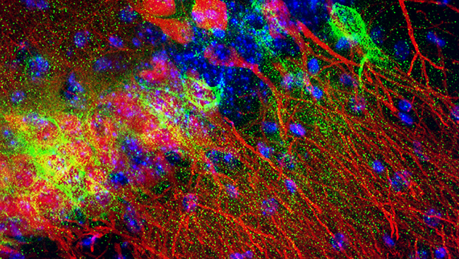 This image from a mouse hippocampus, the portion of the brain responsible for learning and memory, shows perineuronal nets (green) surrounding neurons (red).