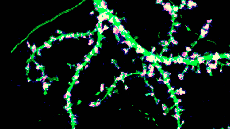 Image of a neuron and its synapses