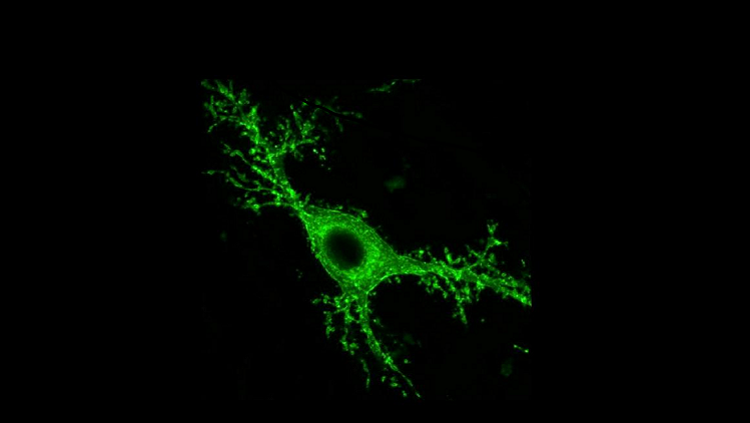 Image of a mossy cell in green