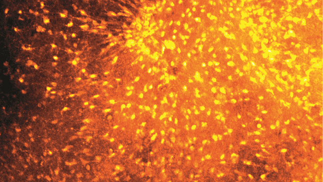 Astrocytes dyed orange.