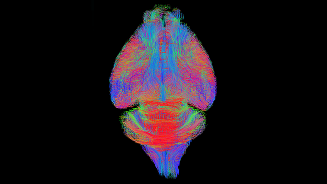 In the mouse brain: Some brain pathways run between the left and right hemispheres (red), while others run from top to bottom (green) and front to back (blue).