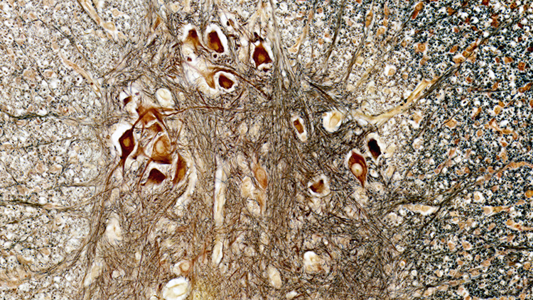 A view of the spinal cord, with large nerve cells running up the spine that can be seen in brown and yellow. 