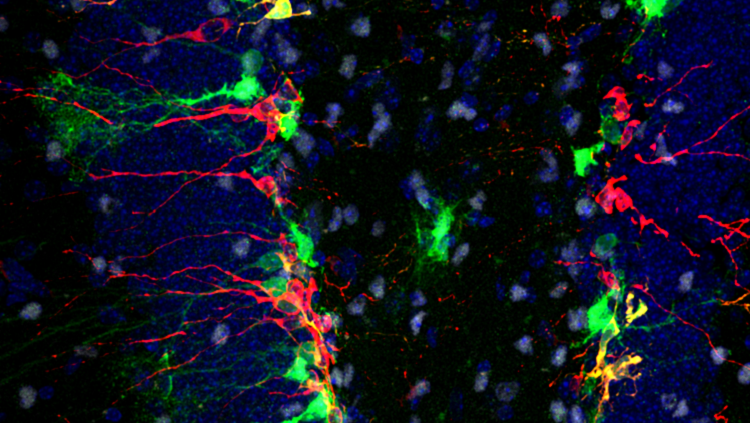 Image of a mouse hippocampus in red, green and blue