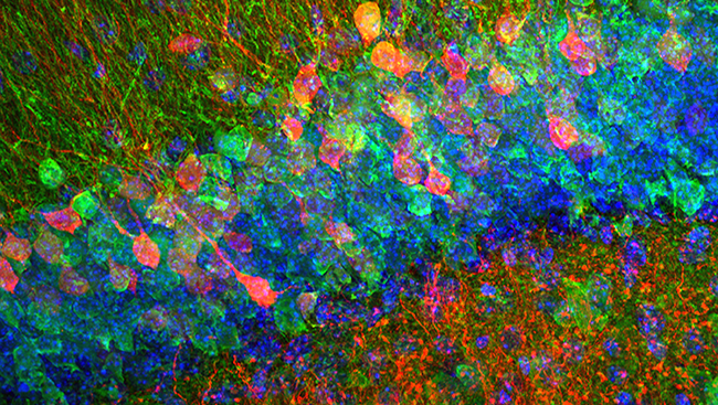 The image above shows the dentate gyrus of an adult mouse with individual cells stained in green and pink. 