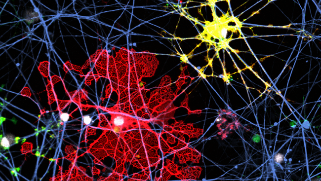 Oligodendrocytes in the brain