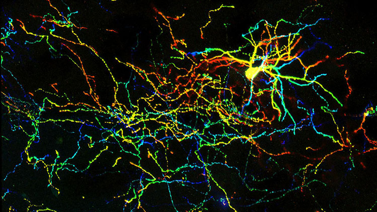 Extensive network of processes of a single interneuron
